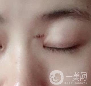 贛州附屬醫(yī)院整形美容科價格表及點痣案例公布，速覽