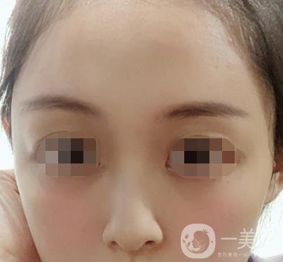 贛州附屬醫(yī)院整形美容科價格表及點痣案例公布，速覽