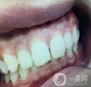 龍崗中心醫(yī)院整牙多少錢？?jī)r(jià)格表2020收費(fèi)明細(xì)公開一覽