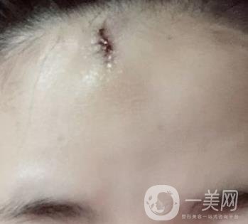 南昌二附院整形美容科價(jià)格表及祛痣日志公開，速覽