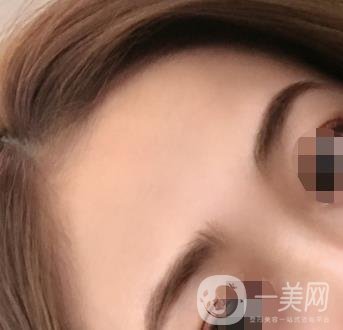 南昌二附院整形美容科價(jià)格表及祛痣日志公開，速覽