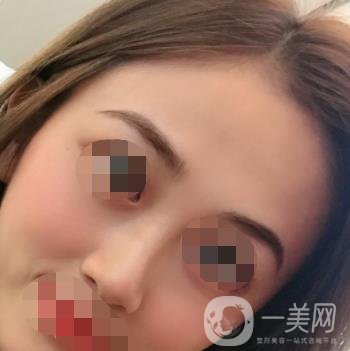 南昌二附院整形美容科價(jià)格表及祛痣日志公開，速覽