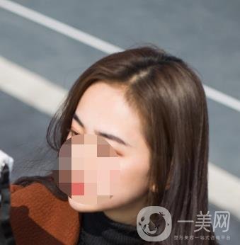 南昌二附院整形美容科價(jià)格表及祛痣日志公開，速覽