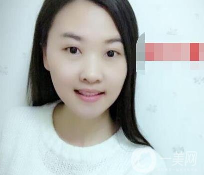 北京市海淀醫(yī)院口腔科價格表2020更新，附牙齒矯正案例