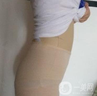 襄陽市第一人民醫(yī)院整形美容科吸脂瘦肚子多少錢？價格表整形日記一覽