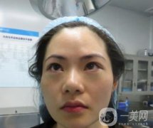 廣州南方醫(yī)院去眼袋費用多少？2020整形價格表一覽