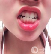 現(xiàn)在廣州曙光醫(yī)院整牙靠譜嗎？全新價格表現(xiàn)已發(fā)布
