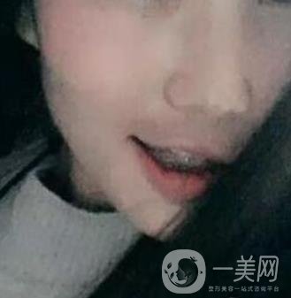 桂林美奧口腔醫(yī)院價格表全新版，附牙齒矯正案例