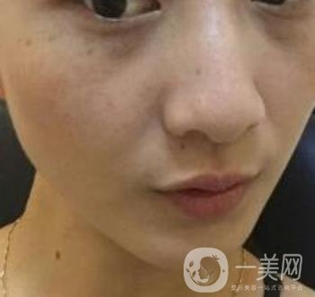 青醫(yī)附院整形美容科價格表及祛斑案例公布，速覽