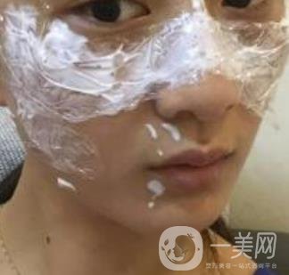 青醫(yī)附院整形美容科價格表及祛斑案例公布，速覽