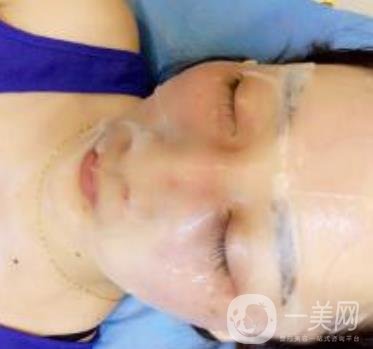 青醫(yī)附院整形美容科價格表及祛斑案例公布，速覽