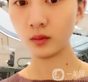 青醫(yī)附院整形美容科價格表及祛斑案例公布，速覽
