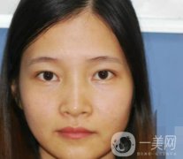 北京朝陽醫(yī)院整形中心紋眉果怎么樣？價格價目表詳情一覽