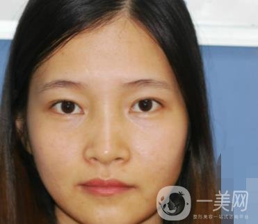 北京朝陽醫(yī)院整形中心紋眉*果怎么樣？價(jià)格價(jià)目表詳情一覽