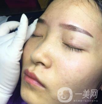 北京朝陽醫(yī)院整形中心紋眉*果怎么樣？價(jià)格價(jià)目表詳情一覽