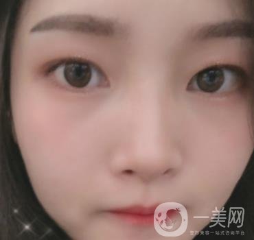 北京朝陽醫(yī)院整形中心紋眉*果怎么樣？價(jià)格價(jià)目表詳情一覽
