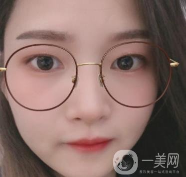 北京朝陽醫(yī)院整形中心紋眉*果怎么樣？價(jià)格價(jià)目表詳情一覽