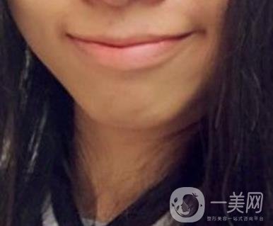 復(fù)旦大學(xué)附屬兒科醫(yī)院口腔科做牙齒矯正多少錢？價格表明細(xì)一覽