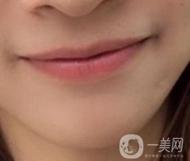 復(fù)旦大學(xué)附屬兒科醫(yī)院口腔科做牙齒矯正多少錢？價格表明細(xì)一覽