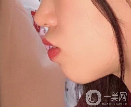 復(fù)旦大學(xué)附屬兒科醫(yī)院口腔科做牙齒矯正多少錢？價格表明細(xì)一覽