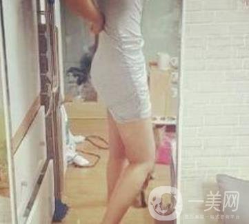 哈爾濱醫(yī)科大學(xué)附屬第一醫(yī)院整形科價(jià)格表和吸脂瘦肚子全新公布