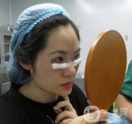 長海醫(yī)院整形美容科價格表，去眼袋手術(shù)果展示