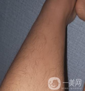 哈醫(yī)大四院整形美容科價(jià)格表鉅惠來襲，附冰點(diǎn)脫毛案例