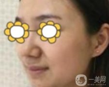 阜陽市人民醫(yī)院整形美容科價格表2020版，附*案例