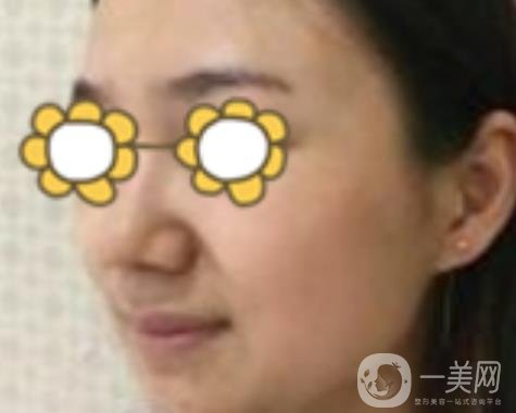 阜陽市人民醫(yī)院整形美容科價(jià)格表2020版，附*案例