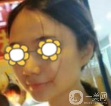 阜陽市人民醫(yī)院整形美容科價(jià)格表2020版，附*案例