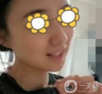 阜陽市人民醫(yī)院整形美容科價(jià)格表2020版，附*案例