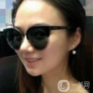 阜陽市人民醫(yī)院整形美容科價(jià)格表2020版，附*案例