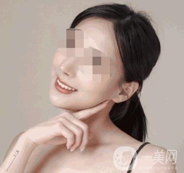 河南省人民醫(yī)院整形美容科價格表公布，附除腋臭案例