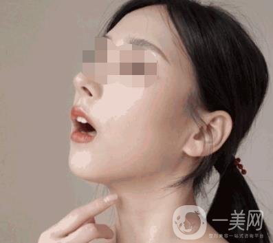 河南省人民醫(yī)院整形美容科價格表公布，附除腋臭案例