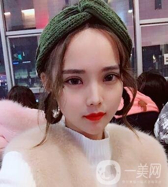 湖南第一醫(yī)院整形科價(jià)格表，附雙眼皮案例