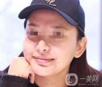 西南醫(yī)院*多少錢？附整形價格表及真實(shí)案例