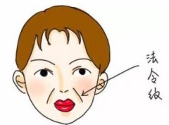 臉上出現(xiàn)法令紋顯老怎么辦？可以試試填充來解決凹陷