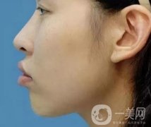 被“凸嘴!”封印的顏值，該如何解決？