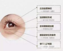 超聲波去眼袋果好嗎？看文章里面都解釋清楚了