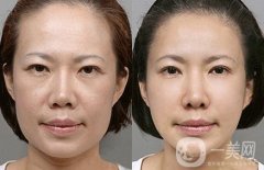 女明星都在做的熱瑪吉究竟有哪些果呢？原來抗初老全靠它