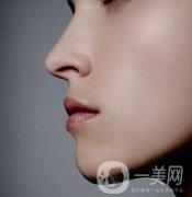 硅膠隆鼻價(jià)格大概是多少？影響價(jià)位的因素有哪些？