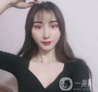 處楊明勇做雙眼皮怎么樣？專家案例_價格（價目）收費反饋~