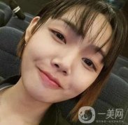 西京整形科價格表收費標準多方面一覽！含專家雙眼皮案例術后照~
