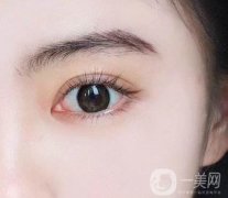 雙眼皮微創(chuàng)多少錢?雙眼皮微創(chuàng)手術(shù)有什么優(yōu)勢?