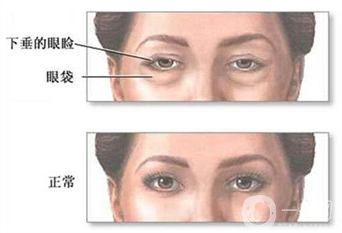 天津公安醫(yī)院整形價(jià)格表2020年，內(nèi)附做眼袋*圖