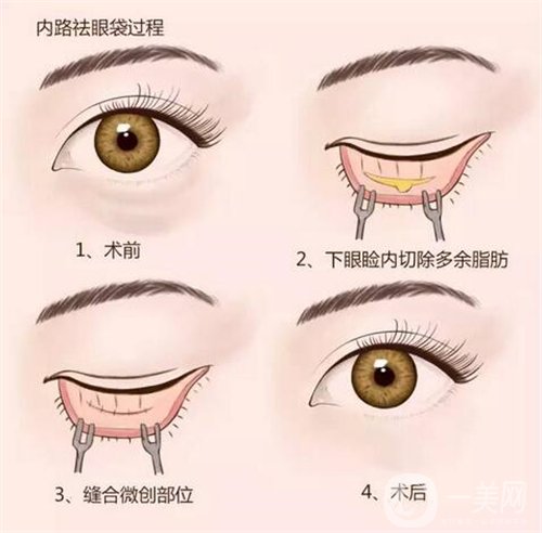 天津公安醫(yī)院整形價(jià)格表2020年，內(nèi)附做眼袋*圖