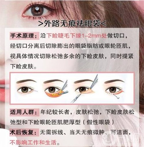 天津醫(yī)科大學(xué)眼科醫(yī)院做眼袋*果如何?價(jià)格價(jià)目表2020年全新公布