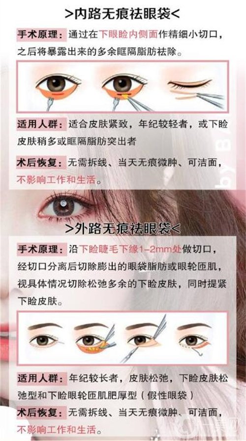 天津醫(yī)科大學(xué)眼科醫(yī)院做眼袋*果如何?價(jià)格價(jià)目表2020年全新公布