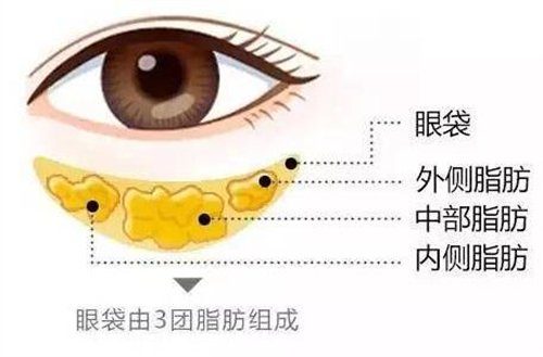 天津醫(yī)科大學(xué)眼科醫(yī)院做眼袋*果如何?價(jià)格價(jià)目表2020年全新公布