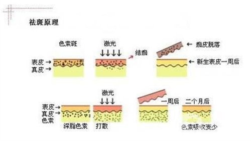 天津醫(yī)科大學(xué)腫瘤醫(yī)院整形科價格表，附激光祛斑恢復(fù)*果圖